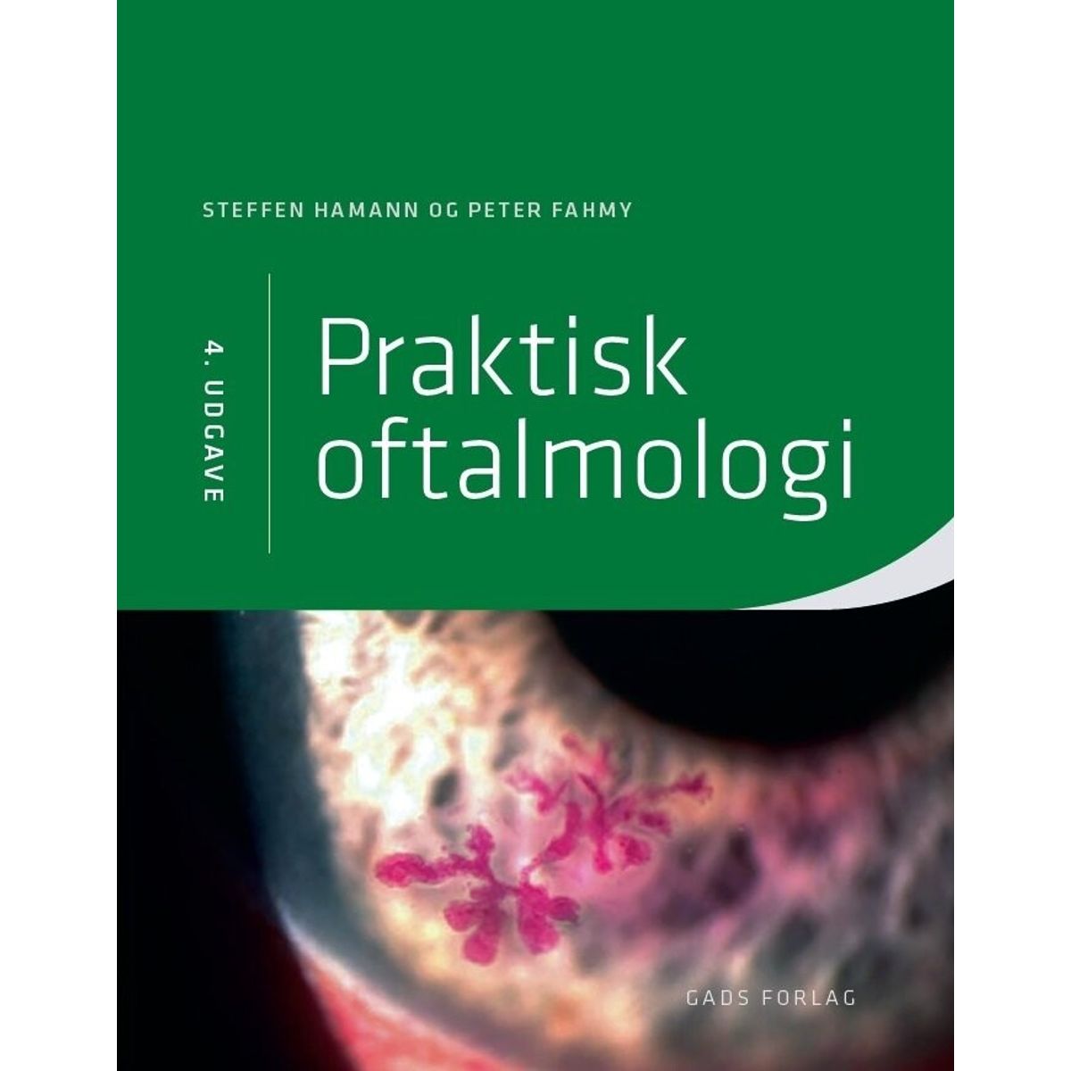 Praktisk Oftalmologi - 4. Udgave - Michael Larsen - Bog