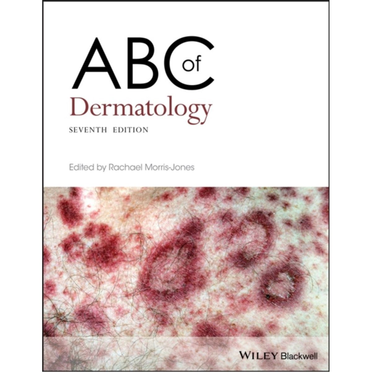 ABC of Dermatology