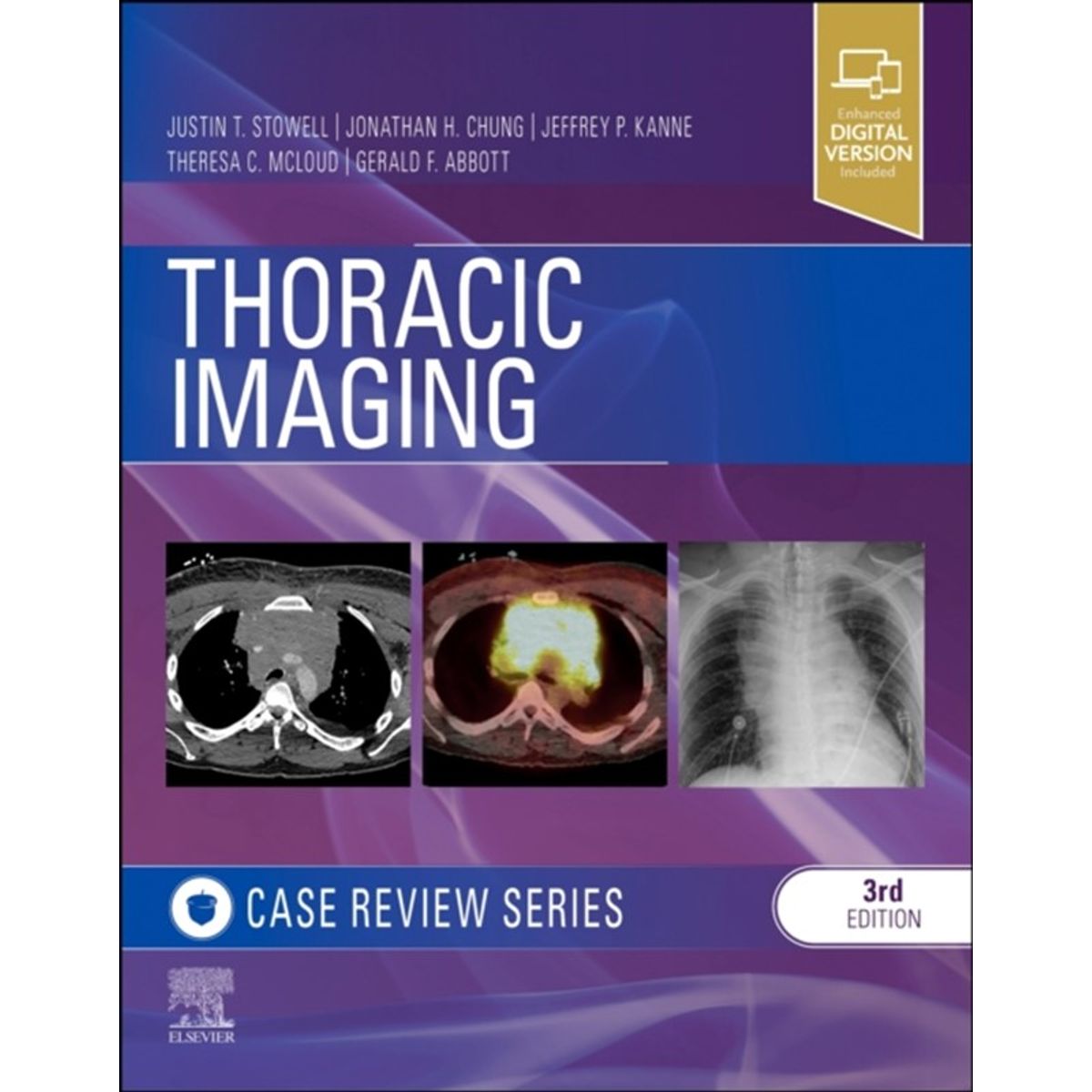 Thoracic Imaging: Case Review