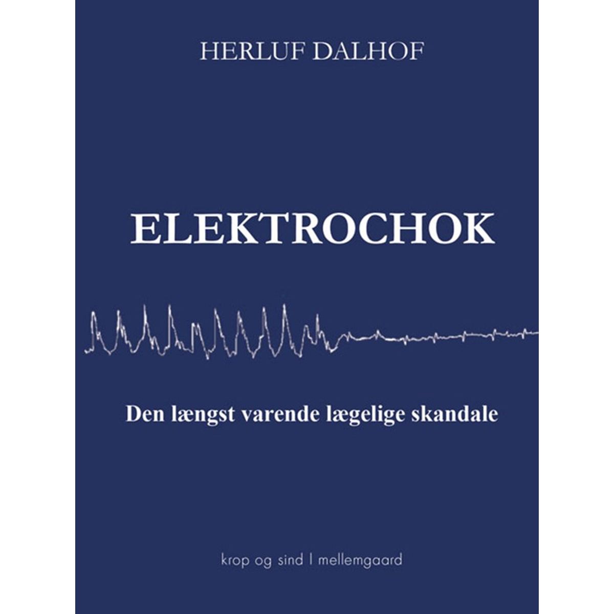 Elektrochok